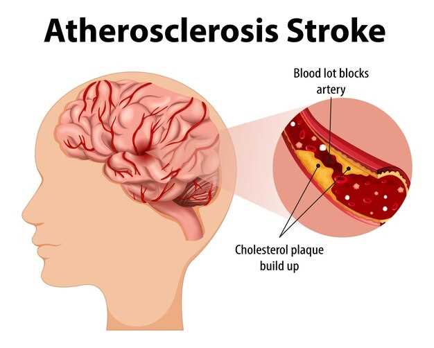 Симптомы и последствия атеросклероза сосудов головного мозга