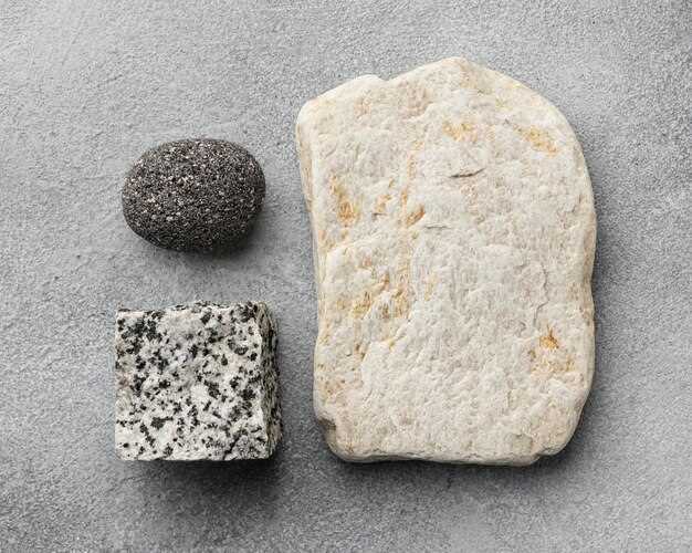 Основные причины образования фосфатных камней